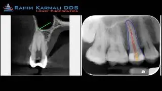What Is An Endodontists and What Do They Do?
