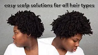 #WashDay Dry ITCHY SCALP Solutions for All Hair Types