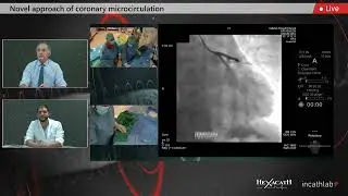 Microcirculation Clinical Cases with RayFlow by Hexacath 2021