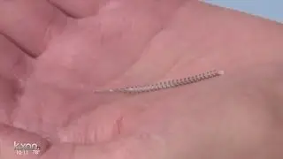 New effort in Congress to make sure doctors report Essure implant problems