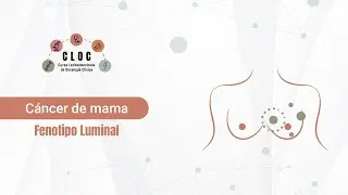Cáncer de mama - Fenotipo Luminal