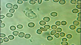 Intelligent Design - Live Blood Image - Macrophagie In Clean Up Action 1