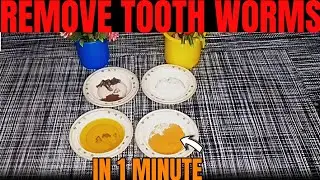 Natural Remedy to 💫Remove Tooth Worms in Just 1 Minute ❤️