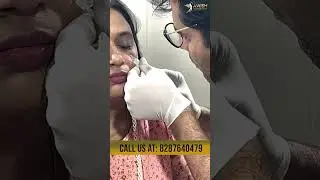 What is this ? 🥹🥹Under eye filler / Dark circles treatment