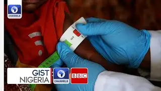 Somalia&rsquo;s Hunger Crisis Deepens Amid Conflict And Aid Cuts