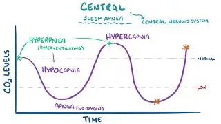 Sleep apnea   causes, symptoms, diagnosis, treatment, pathology 1