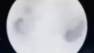 ELO's Metal Blizzard, 1st EP Trailer
