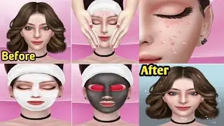 ASMR hospital doctor games level 02 Acne Removal || Mind ASMR