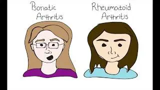 Rheumatoid Factors