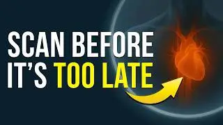 Hidden Plaque Alert: Why a &ldquo;Good&rdquo; Calcium Score Can Mislead You (Cardiovascular Series) Ep. 10