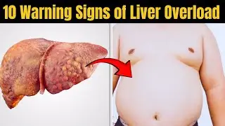 10 Signs of Liver Overload
