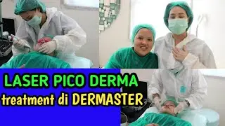 PERAWATAN WAJAH DI DERMASTER || LASER PICO DERMA