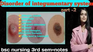 Disorders of integumentary system|part -2|AHN|bsc nursing 3rd sem 