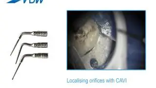 VDW Dental &middot; How To: VDW.ULTRA - Localising orifices with CAVI
