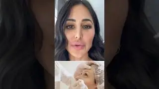 Bollywood Celebrity Plastic Surgeries: Unveiled | Katrina Kaif  |  Anushka Sharma | Rakhi Sawant 🏥