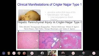 Gastroenterology Friday Lecture Series: Metabolic Liver Diseases (September 16, 2021)