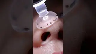 &ldquo;Slow Vacuum Glide 8K 🎥 | Satisfying Air Flow & Whisper ASMR&rdquo;
