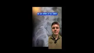 Spondylolisthesis | Tylor the Chiropractor | Columbus, OH