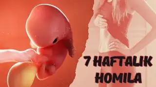 7 haftalik homila