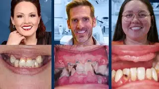 3 Smile Transformations That Will Leave You Speechless!