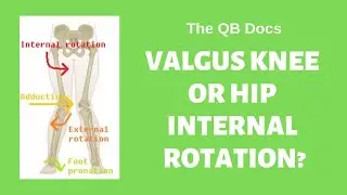 The QB Docs: Hip Internal Rotation vs Knee Valgus