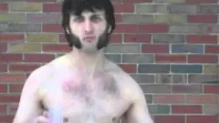Best Survivor Audition Ever