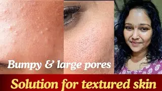 👌🔥 Best Solution For Textured & Bumpy Skin #texturedskin#largepores #acne #skincareroutine#oilyskin