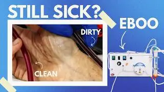 Why You&rsquo;re Still Sick Even After Labs, Supplements, and Diet Changes: EBOO is the solution!