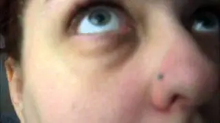 eye twitch