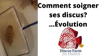 comment j'ai soigné mes discus