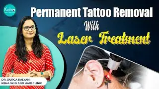 Permanent Tattoo Removal With Laser Treatment || Laser Tattoo Removal || Keha's Skin Clinic
