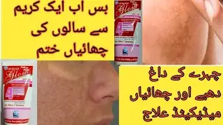 Face ki Chaiyan Khatam Krny Ka Tarika | Pigmentation Treatment | MELASMA, Chaiyan Medicated Cream