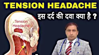 TENSION HEADACHE || इस दर्द की दवा क्या है ? || Dr Kumar education clinic