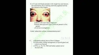 Medicine OSCE || 15 Stations With Explanation || NLE step 2 || Final Year MBBS || Dr M B