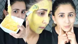TURMERIC FACE MASK: FIGHT ACNE & HYPERPIGMENTATION, BRIGHTEN SKIN (Only 2 Ingredients!)
