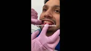 Montaje de modelos en articulador de bisagra