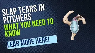 How to Identify Shoulder Labrum Tears in Throwers