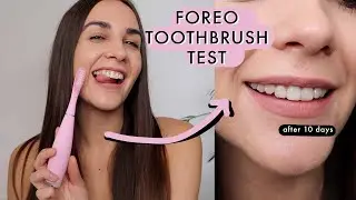I'VE TRIED FOREO ISSA 3 SONIC TOOTHBRUSH FOR 10 DAYS | BEFORE AND AFTER  *i'm in love*