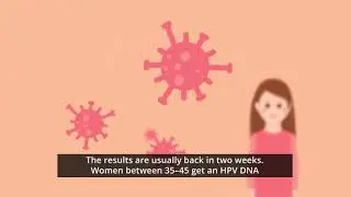 Cervical cancer screening | #preventionmatters