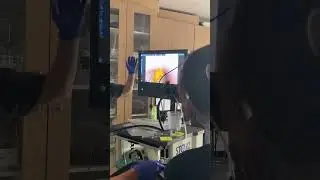 Foreign object removal through endoscopy