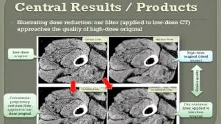 CT Dose Reduction with Nonlinear Image Filters - Oleg Pianykh