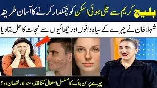 How to Remove Dark Spots & Pimples on Face? | Bleach Skin Burn Treatment | Madeha Naqvi | SAMAA TV