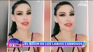 Sheyla Rojas: Otras figuras de la far&aacute;ndula que recurrieron al aumento de labios