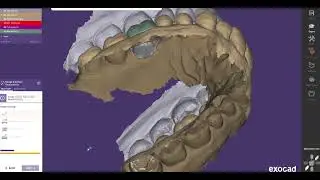 VITA DENTAL LAB