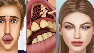 remove botfly maggots found inside mountaineer mouth