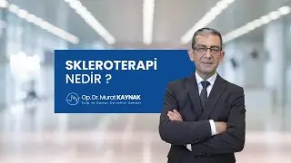 Skleroterapi Nedir ? - Murat Kaynak Anlatıyor: Varis Tedavisinde Etkili Y&ouml;ntem