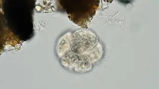 Cell division in a reproductive cyst of single-celled organisms (ciliates from Colpodidae family)