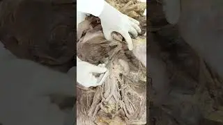 Why right kidney is lower than left?