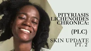 Pityriasis Lichenoides Chronica : Skin Update Pt.2 | Roginea Dixon