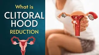 Clitoral Hood Reduction Explained: Procedure, Benefits, Risks & Recovery | Intimate Health